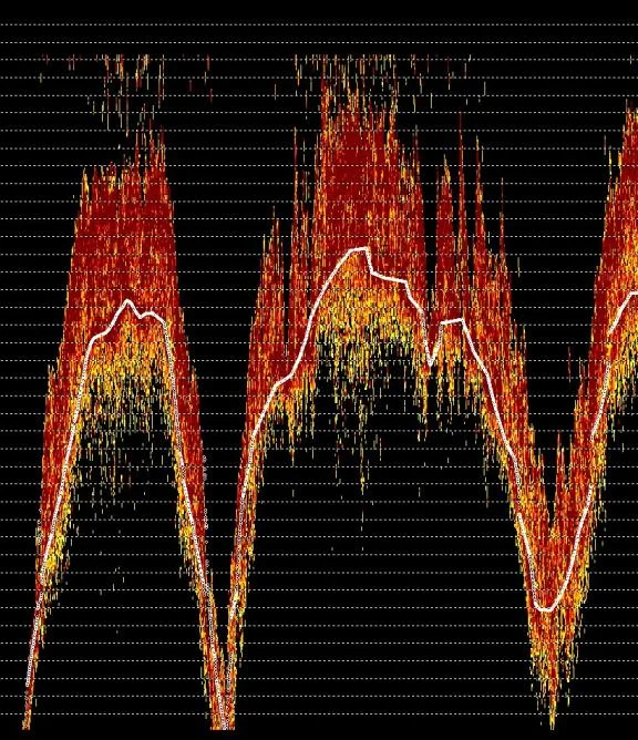 HYPACK echogram with a white line tracing the true bottom beneath tall dense plant canopy